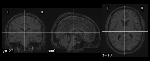 ../_images/Introduction_to_Neuroimaging_Data_41_1.png